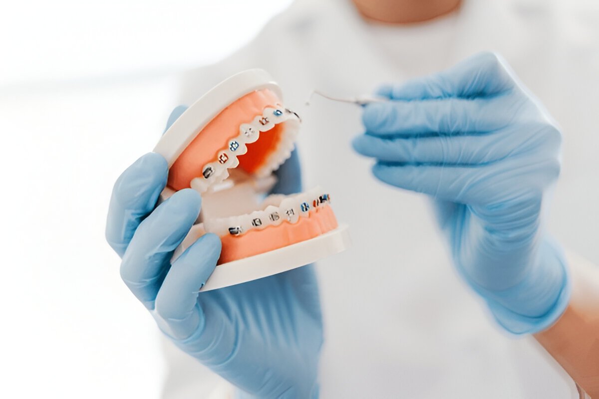 Orthodontics – Fort Saskatchewan